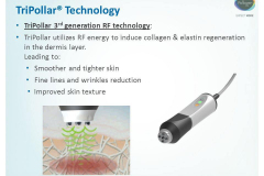 TriPollar 3rd generation RF technology: TriPollar utilizes RF energy to induce collagen & elastin regeneration in the dermis layer. Leading to: Smoother and tighter skin. Fine lines and wrinkles reduction. Improved skin texture.